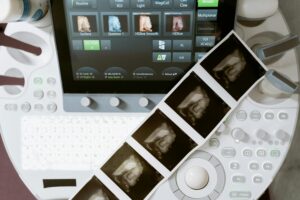 How to Get Into a Competitive Sonography Program