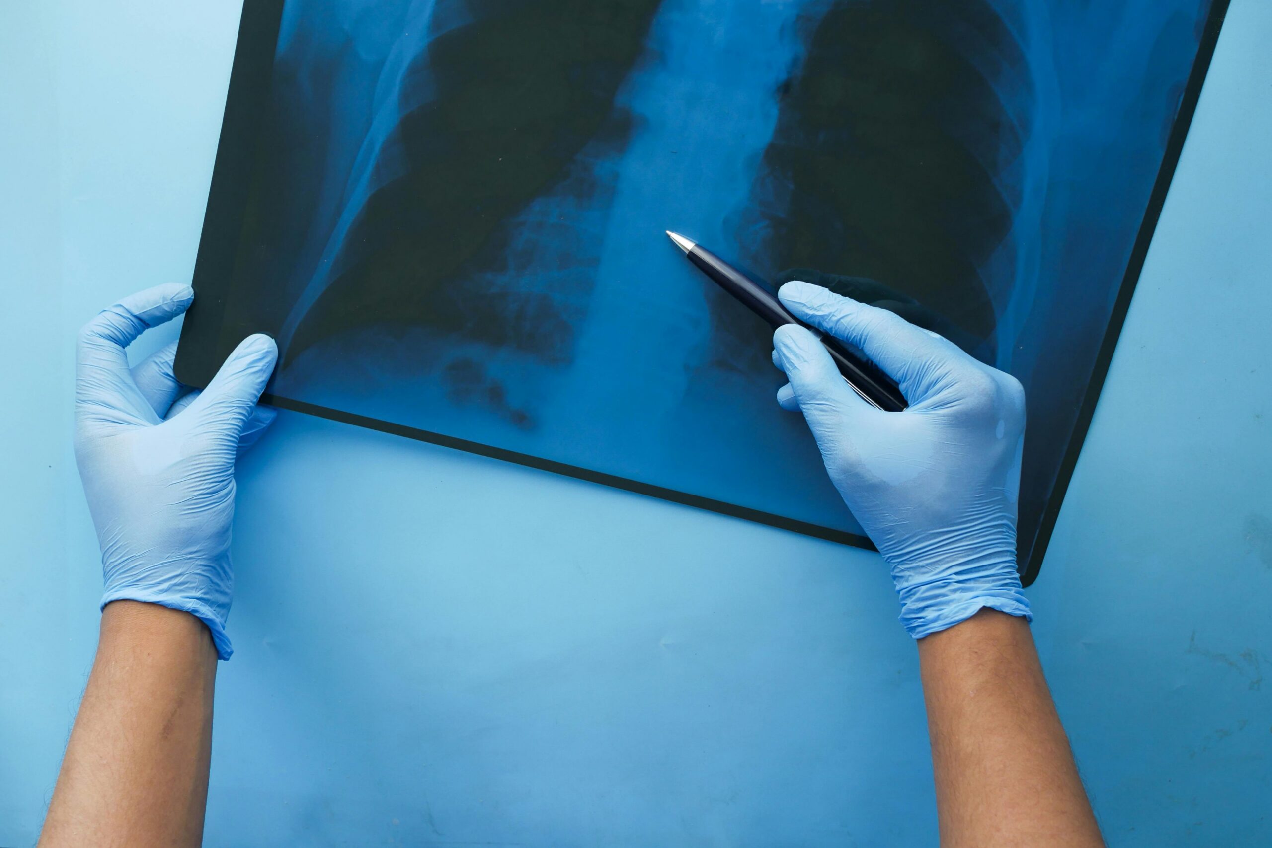 Medical Terminology for Respiratory Therapy: Why It Helps and How to Take It Online